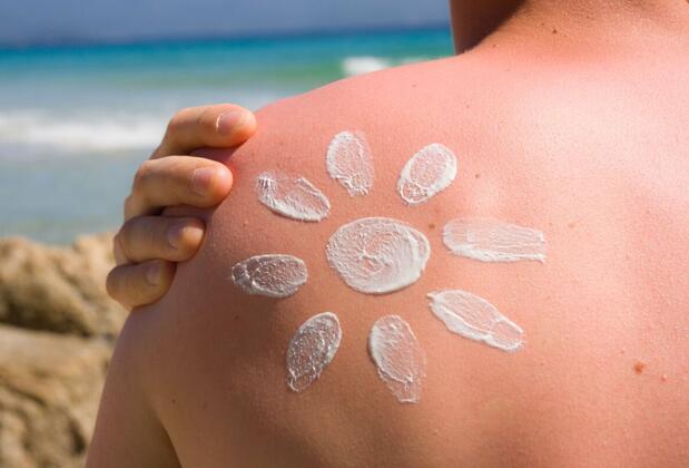 Güneş Yanığına Ne İyi Gelir?